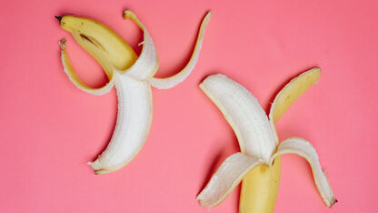 Een bananenschil over je huid wrijven? Dit is waarom je dat wilt doen!