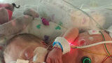 Jowi?s baby werd geboren met 26 weken: ?We leefden tussen hoop en vrees?