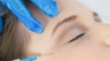 Botox: laat me niet lachen (maar liever wel) 