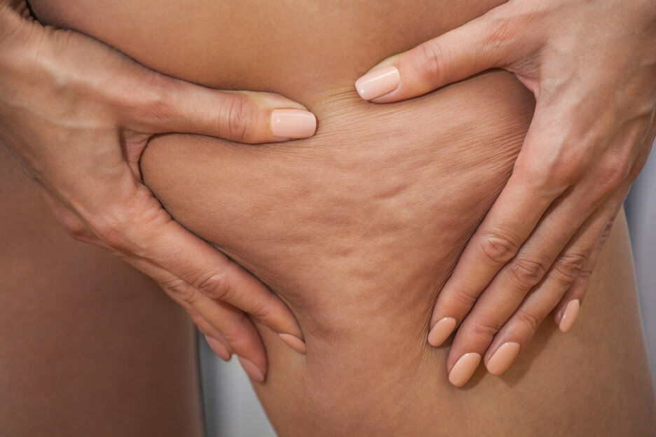 Scrub hier je huid mee om van cellulitis af te komen