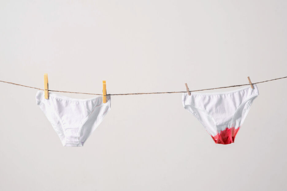 menstruatievlekken