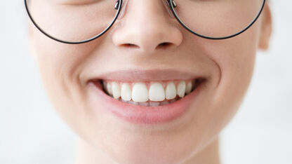 De beste tips tegen droge lippen