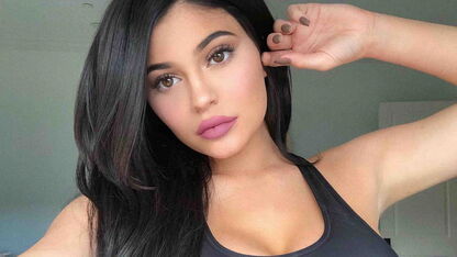 Deze cosmetische ingrepen liet Kylie Jenner meteen na haar bevalling doen 