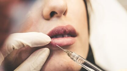 Botched lipfillers laten oplossen: waarom de 'natural look' nu toch weer in is