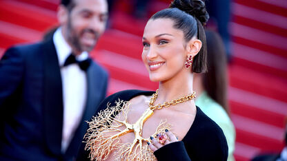 WOW! Fans in shock na ziekenhuisfoto’s Bella Hadid