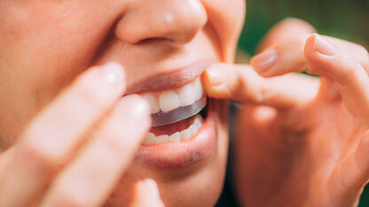 Zijn whitening strips wel veilig voor je tanden?