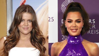 Khloé Kardashian onthult welke cosmetische ingrepen zij allemaal heeft gedaan