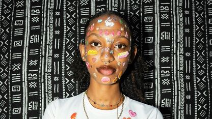 Lifehack: blarenpleisters als pimple patches?