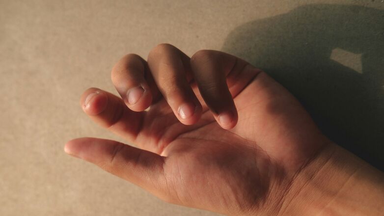 Zo stop je met nagelbijten