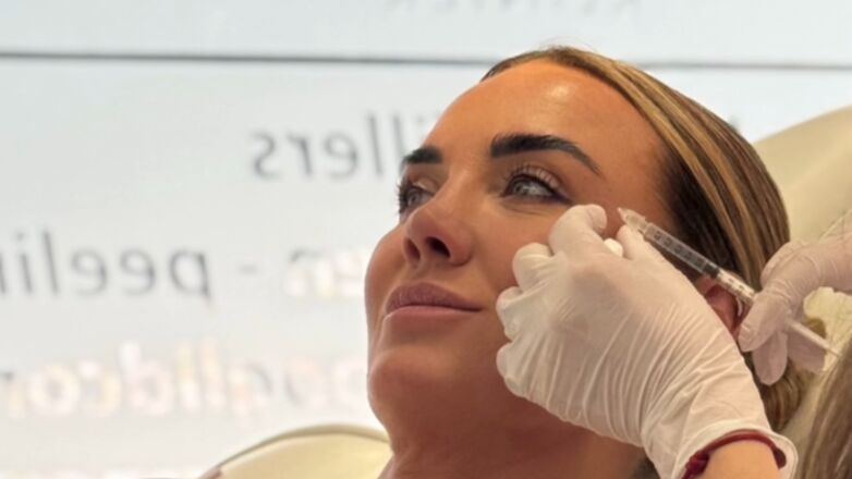 Oeps! deze BN'ers gebruiken gewoon botox