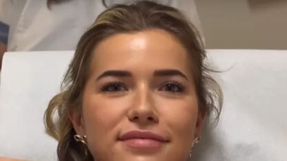 Influencers met fillers: deze creators laten álles zien