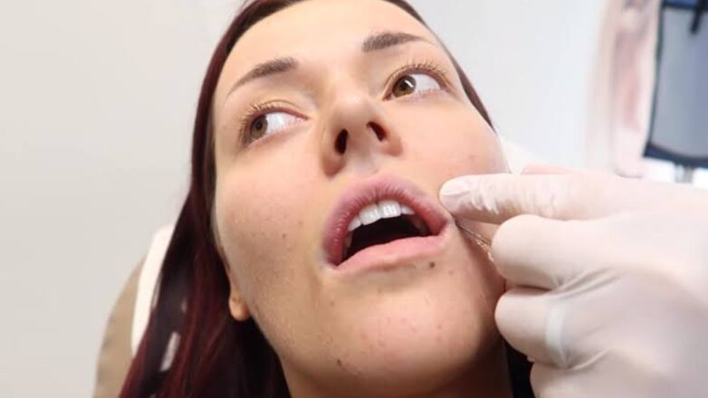 Oops... Deze BN'ers hebben spijt van cosmetische ingrepen